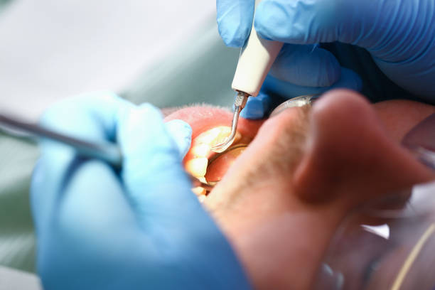 Best Tooth Infection Emergency Dentist  in Spearville, KS