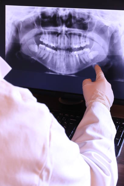 Best Emergency Tooth Extraction  in Spearville, KS