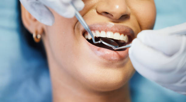 Best Emergency Gum Pain Relief  in Spearville, KS